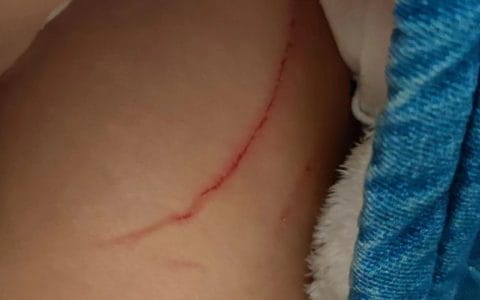 女儿差点被打死